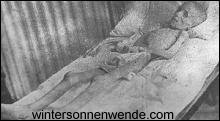 Verhungertes Burenkind im britischen KZ Bloemfontein
